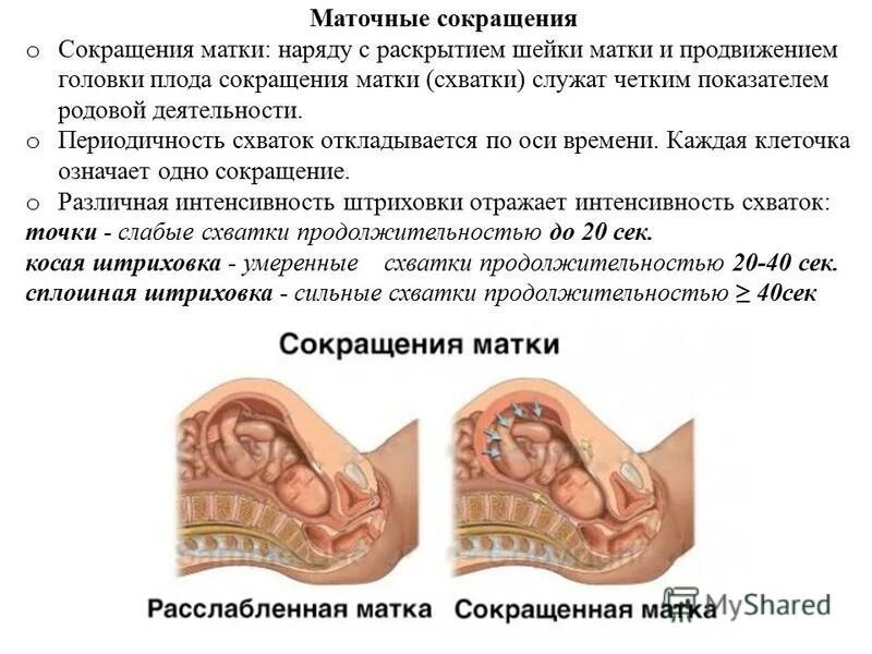 Сильные сокращения матки. Сильные сокращения матки. Сокращение матки в родах. Закон тройного нисходящего градиента. Средства стимулирующие мускулатуру матки.