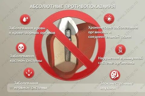 Тошнота имплантация