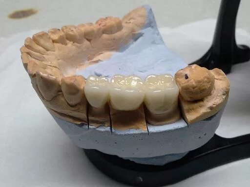 зубной техник симферополь