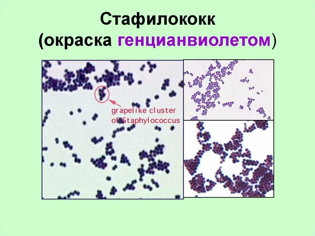 Стафилококки окраска. Стафилококк окраска по граму. стафилококки генцианвиолет. золотистый стафилококк окраска по граму. золотистый стафилококк микробиология препарат.