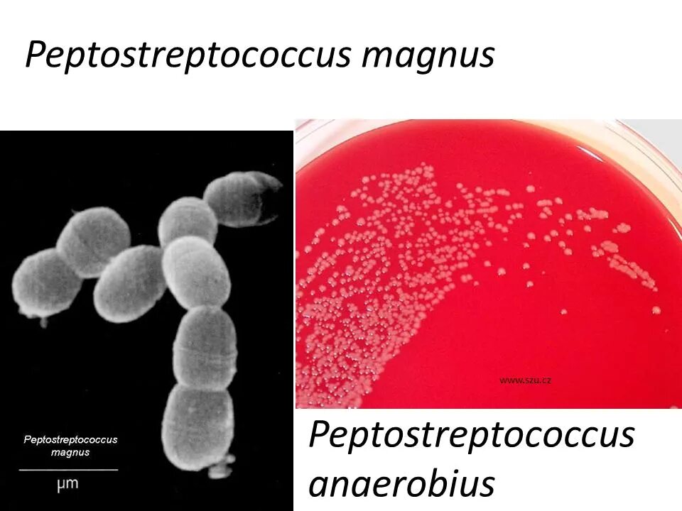 Peptostreptococcus spp