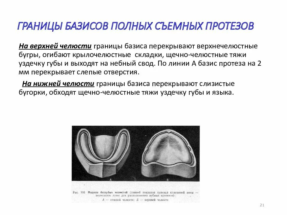 Длина базиса. Границы базиса на нижней челюсти. Границы базиса протеза на верхней челюсти. Граница базиса протеза на нижней челюсти. Границы базиса на верхней челюсти.