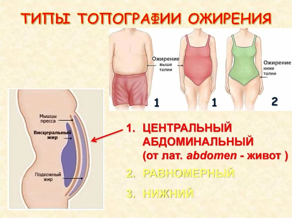 Абдоминальный Тип ожирения. Типы ожирения живота у женщин. Ожирение по абдоминальному типу. Абдоминальное и висцеральное ожирение.