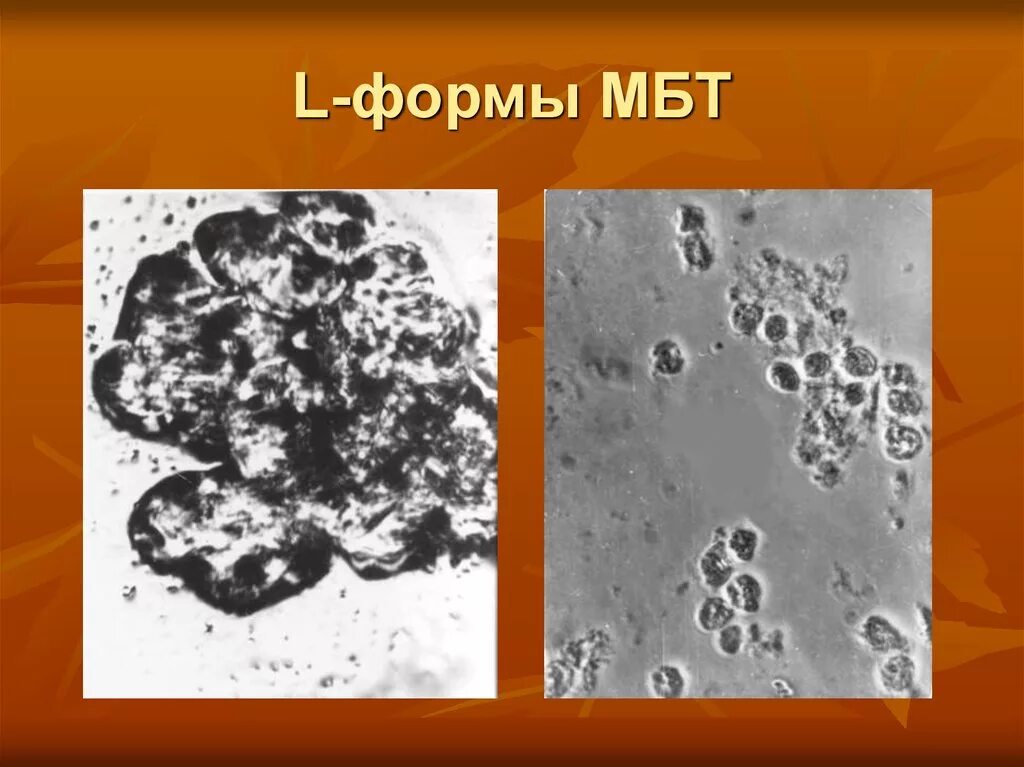 L форма микобактерии туберкулеза это. Л формы МБТ. Туберкулезная инфекция l-формы. L формы бактерий.