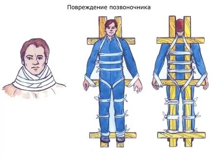 В каком случае шину накладывают поверх одежды