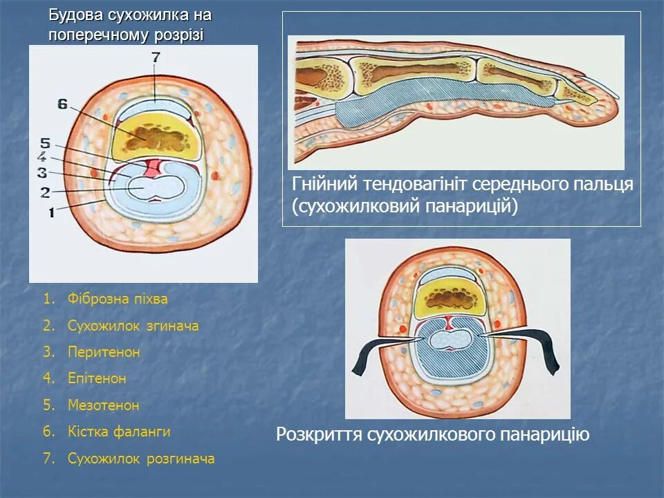 строение мизинца руки человека. ногтевая пластина гистологическое строение. ногтевая фаланга пальца руки анатомия. сетчатый слой дермы гистология. поперечный срез пальца топографическая анатомия.