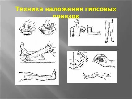 Техники гипса