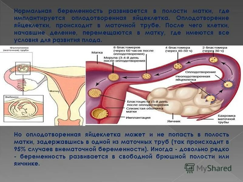Яйцеклетка в брюшную полость. Оплодотворение происходит в ампулярной части маточной трубы. оплодотворение беременность. яйцеклетка в маточной трубе. беременность оплодотворение яйцеклетки.