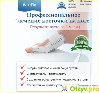 Как лечить косточку на большом пальце