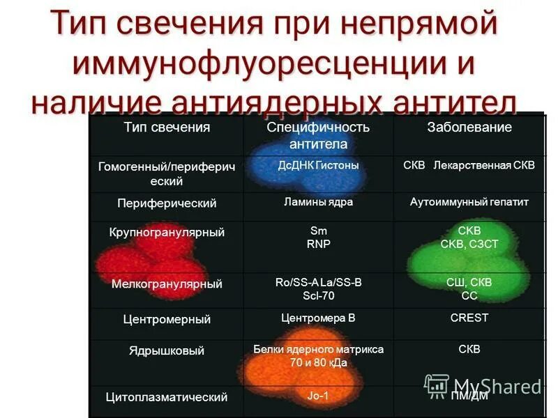 гранулярный тип свечения анф. ядерный гранулярный тип свечения. ядерный мелкогранулярный тип свечения ас-4. мелкогранулярный тип свечения. титр антинуклеарного фактора норма.