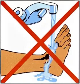 Можно промывать рану водой. Запрещено промывать рану водой. Ожоги нельзя промывать водой. Запрещается промывать рану водой картинка.
