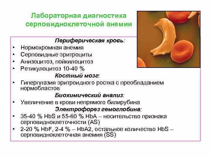 Метод диагностики серповидноклеточной анемии. Серповидноклеточная анемия показатели крови. Серповидноклеточная анемия диагностические критерии. Картина крови при серповидноклеточной анемии. Серповидно клеточная анемия признаки