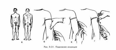 Как ставить уколы подкожно видео. Как ставить уколы подкожно видео