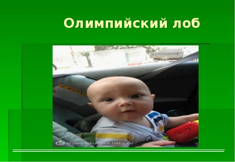 quot;Олимпийский" лобПодскажите, очень прошу!!! 20 ответов форум Babyblo