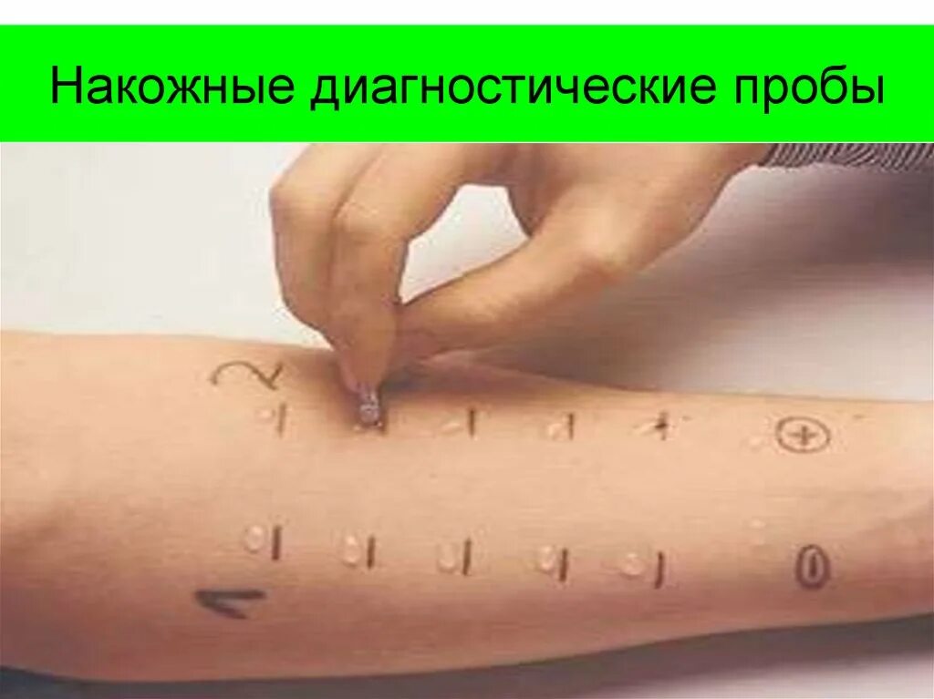 Аллергопроба как делают