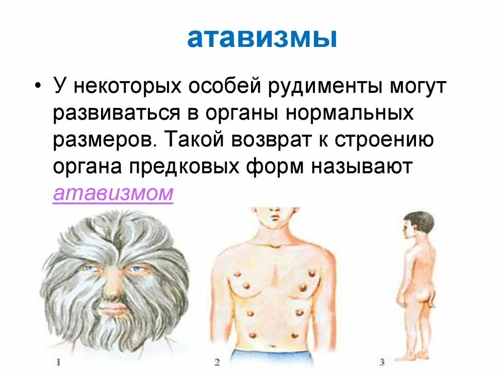 Атавизмы и их примеры Сравнительно- анатомические свидетельства эволюции. Биология 11 класс.