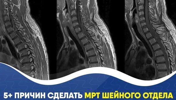 Мрт рокоссовского. Мрт волгоград. мрт плюс в волгограде. комсомольская 4 волгоград мрт. сияние мрт волгоград.