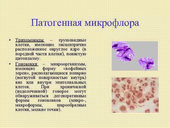 Патогенная форма трихомонады. Остегенная микрофлора. Микроорганизмы женских половых органов