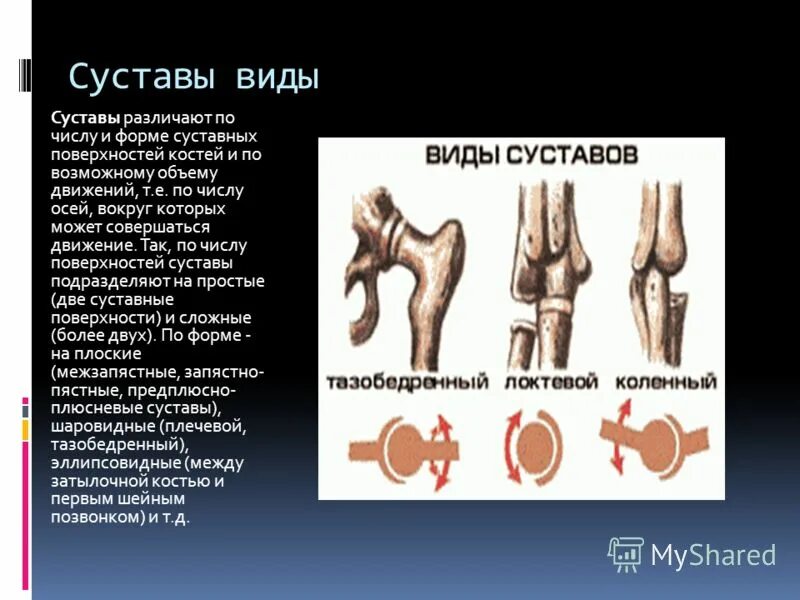 Какой сустав изображен. Суставы, по числу суставных поверхностей различают. Форма суставной поверхности. Классификация суставов по количеству осей. Суставы по форме поверхности.