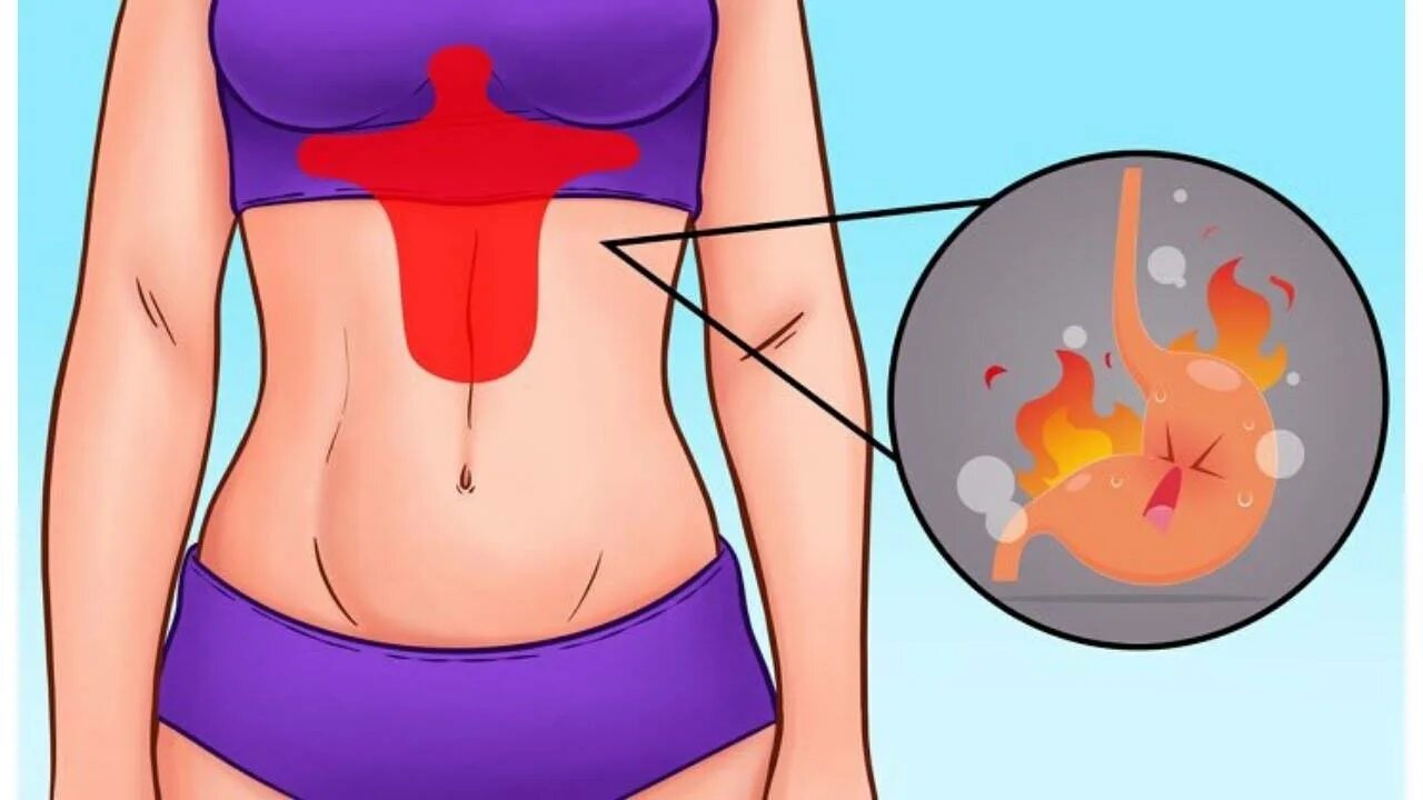 Боли в желудке посередине. Жжение в животе. Болит желудок вверху посередине что. Локализация боли в животе. Острая боль в животе.