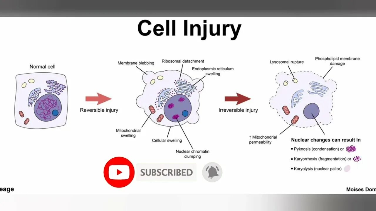 Write cell. Cell. cell damage. клетка the cell. mechanisms of reversible injury..