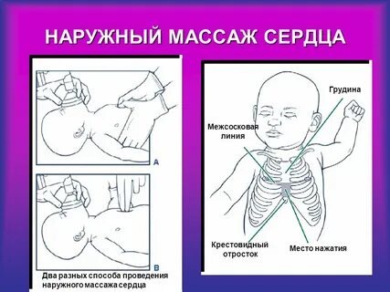 Граница средней и нижней трети грудины