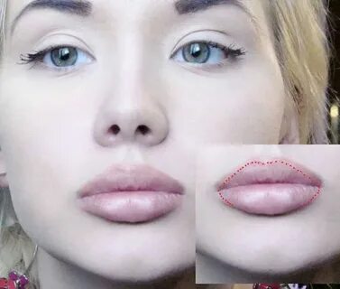 Увеличивает ли губы татуаж