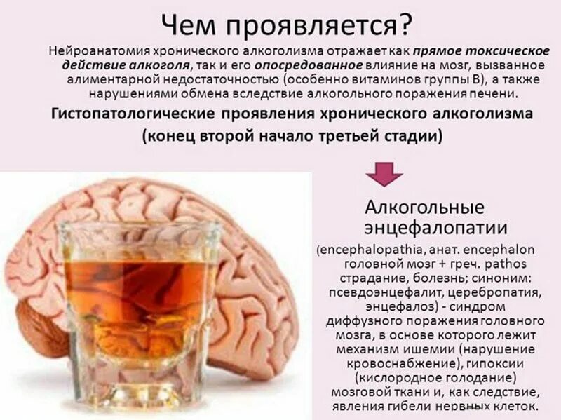 дисциркуляторная энцефалопатия головного мозга на кт. этиологические факторы цирроза печени. примеры основного заболевания. энцефалопатия сложного генеза. алкогольный генез.