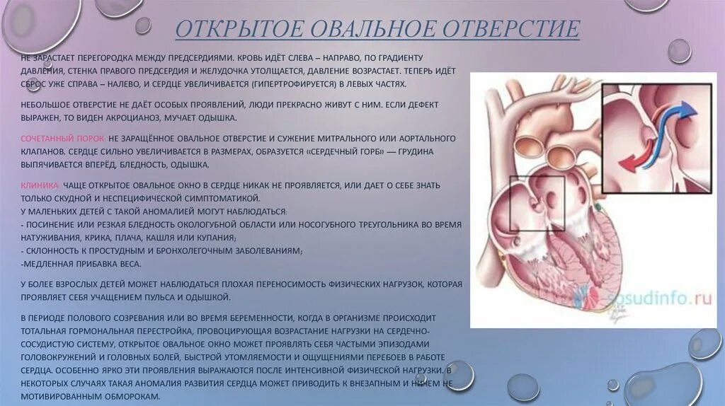 Функционирующее овальное окно. Врожденный порок сердца открытое овальное окно. врожденный порок сердца овальное окно. открытое овальное окно у детей норма. овальное окно в сердце у детей.
