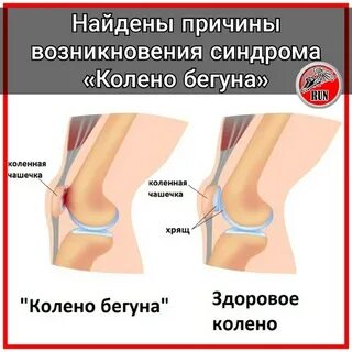 Колено бегуна