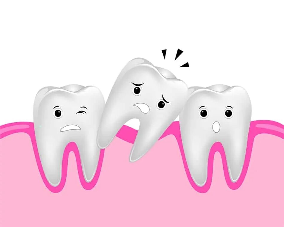 Кариес шатается зуб. Передние резцы у детей. Кариес шатается зуб. Здоровый и больной зуб. Пломбы стоматологические.