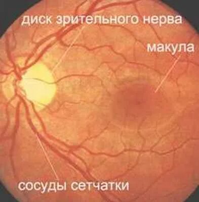 Макула и дзн. Макула и диск зрительного нерва. диск зрительного нерва макула сетчатка.