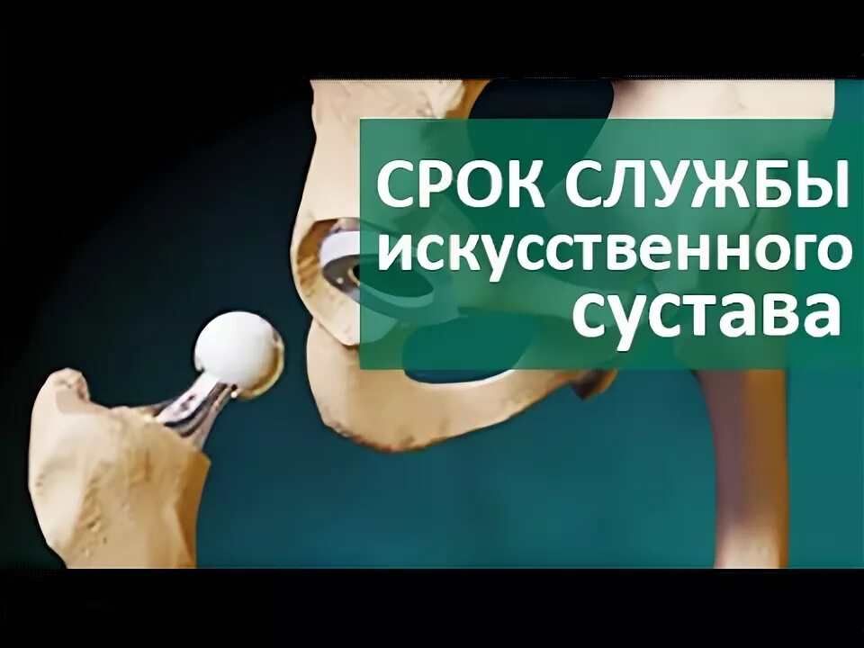 Операция коленного сустава по квоте. Срок службы эндопротеза коленного сустава. Протез коленного сустава по квоте. Эндопротезирование коленного сустава по квоте.