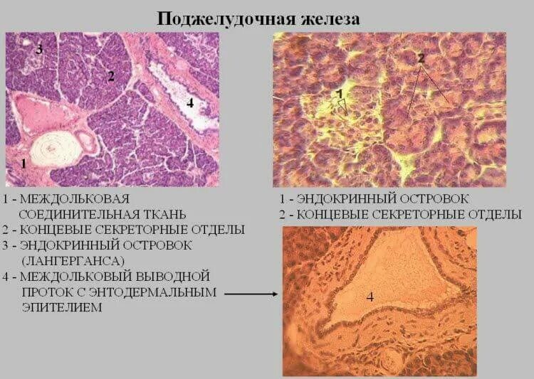 Эпителий печени и поджелудочной железы. Островки Лангерганса поджелудочной железы гистология препарат. Панкреатический островок гистология препарат. Поджелудочная железа гистология препарат. Островки Лангерганса гистология препарат.