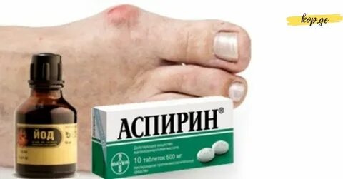 Лечение аспирином