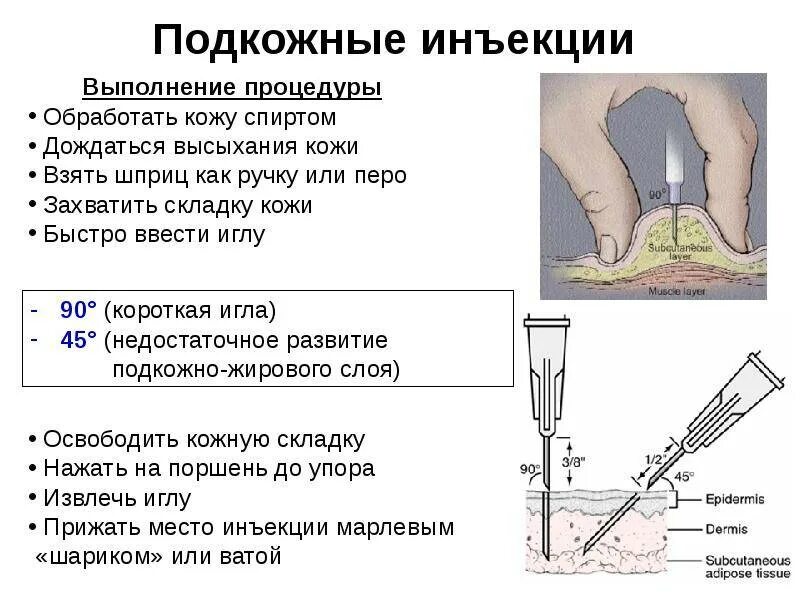 Подкожные инъекции техника выполнения. Алгоритм инъекции подкожной инъекции. Техника подкожной инъекции алгоритм. Схема подкожного введения уколов. Алгоритм подкожной инъекции алгоритм.