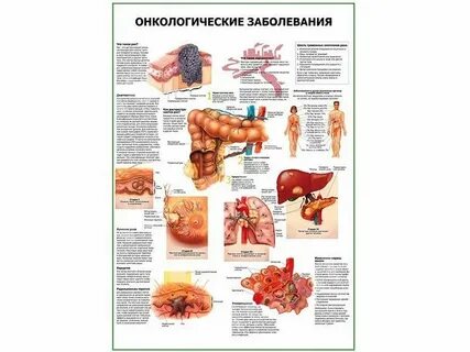 Последствия онкологии
