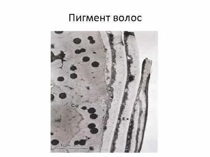 Меланин в волосах