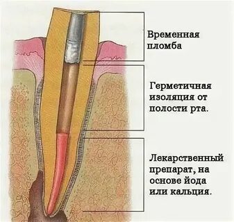 Сколько нельзя есть после мышьяка