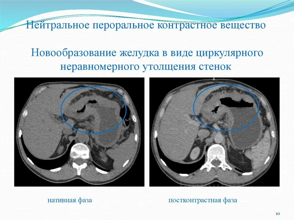 Плохо после контраста кт