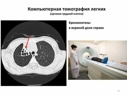 Обязательно делать кт
