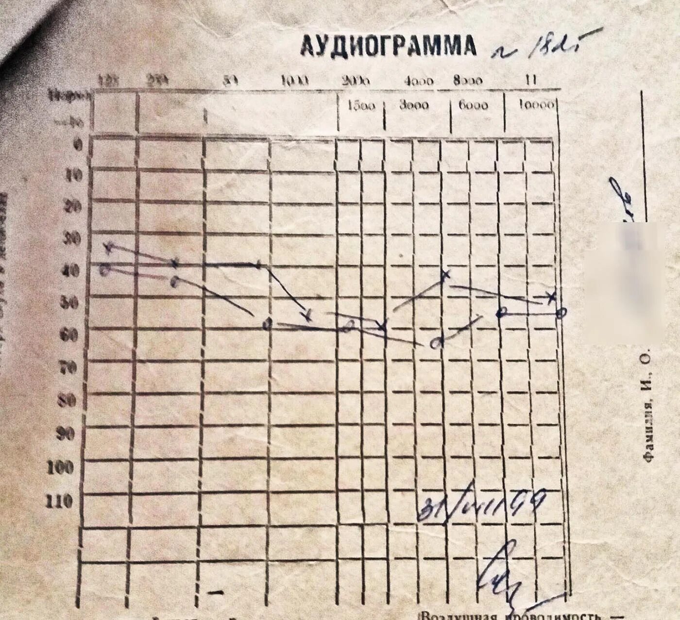 Расшифровка аудиограммы