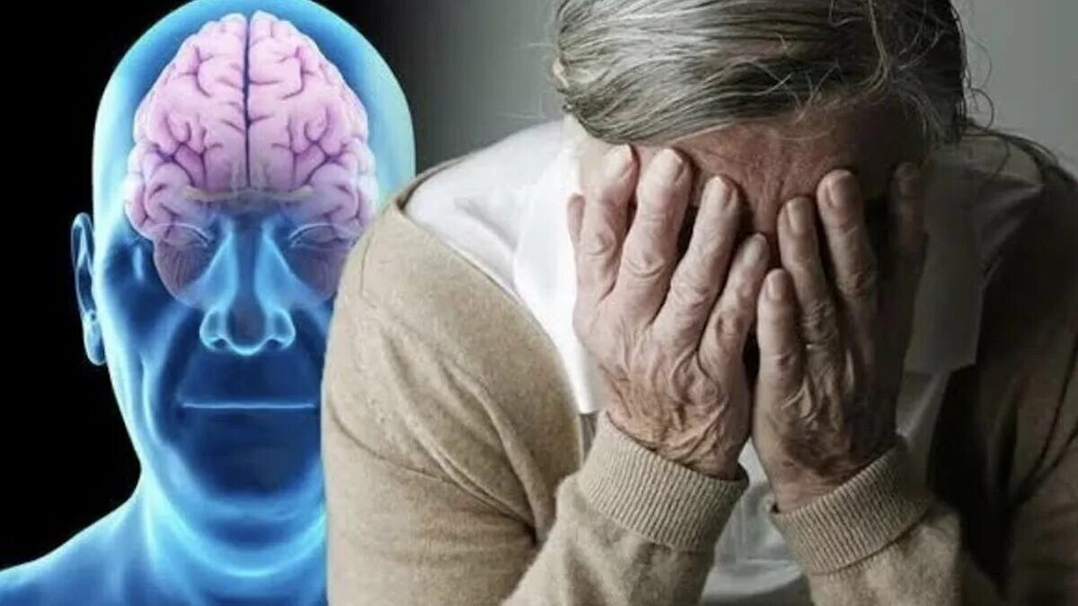 Болезнь мозга у пожилых. Деменция Альцгеймера. Мозг пожилых людей. Старческая память. Ухудшение памяти.