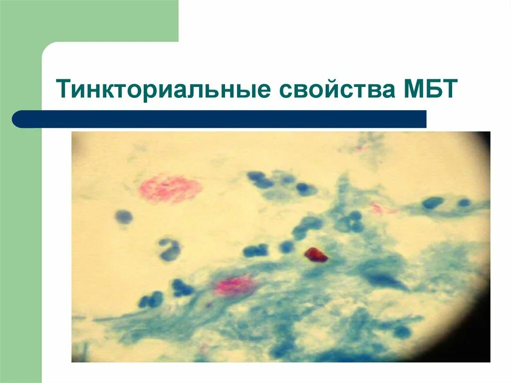 Тинкториальные свойства бактерий цели и методы окраски. Морфологические и тинкториальные свойства бруцеллеза. Окраска бактерий по романовскому гимзе. Морфологические и тинкториальные свойства бактерий методы окраски. Бациллы морфологические и тинкториальные свойства.