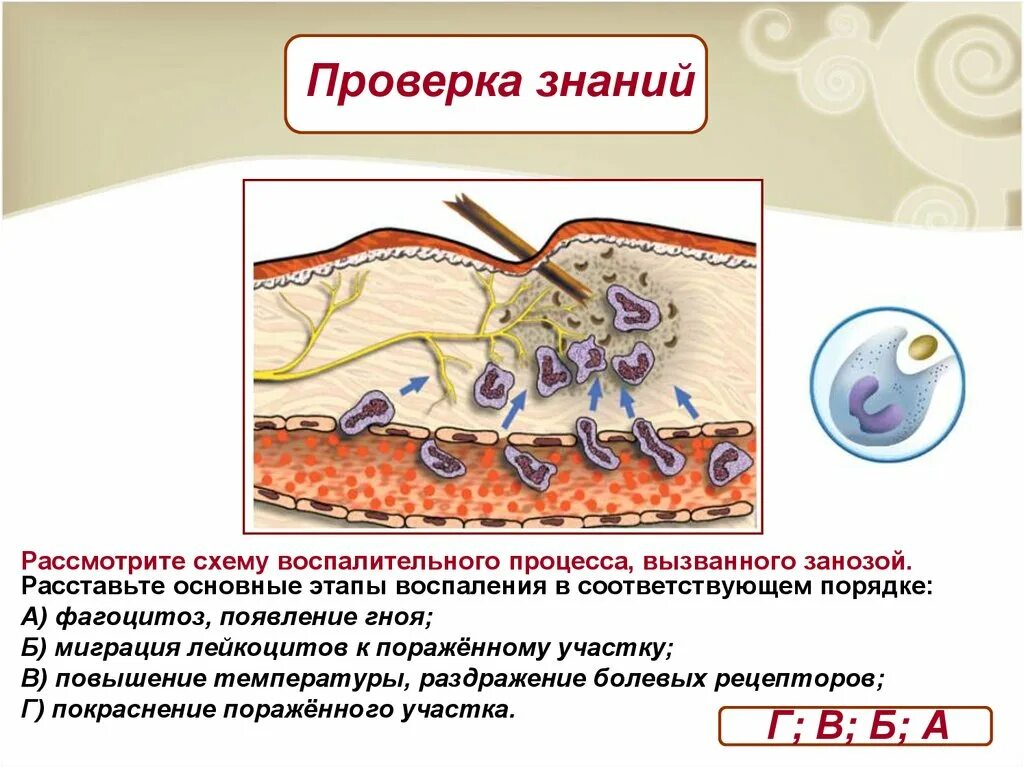 Почему появляются воспаления. Схема воспалительного процесса. Воспалительный процесс. Рассмотрите схему воспалительного процесса.. Фагоцитоз воспаление вызванное занозой.