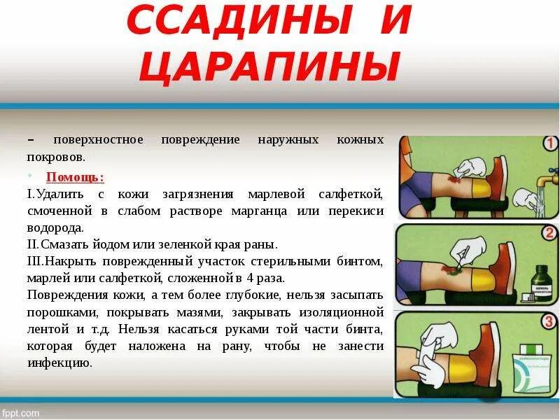 После сильного падения. Оказание первой помощи при ушибах и ссадинах. Оказание первой помощи при повреждении кожи. Оказание первой помощи при царапинах. Оказание первой помощи при порезах.