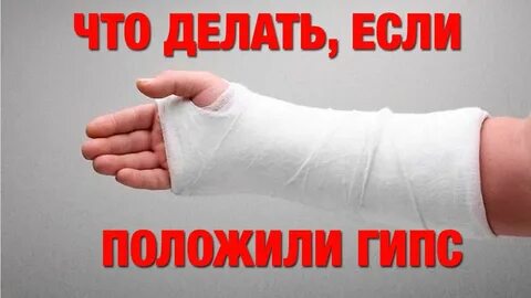 Сроки ношения гипса