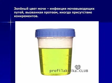 Моча светло зеленого цвета