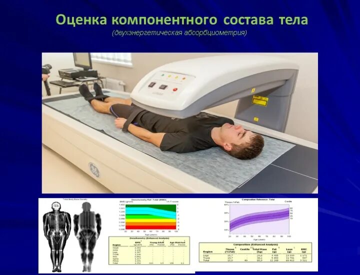 Оценка компонентного состава тела. Двухэнергетическая рентгеновская абсорбциометрия. двухэнергетическая рентгеновская денситометрия. компонентный состав тела.