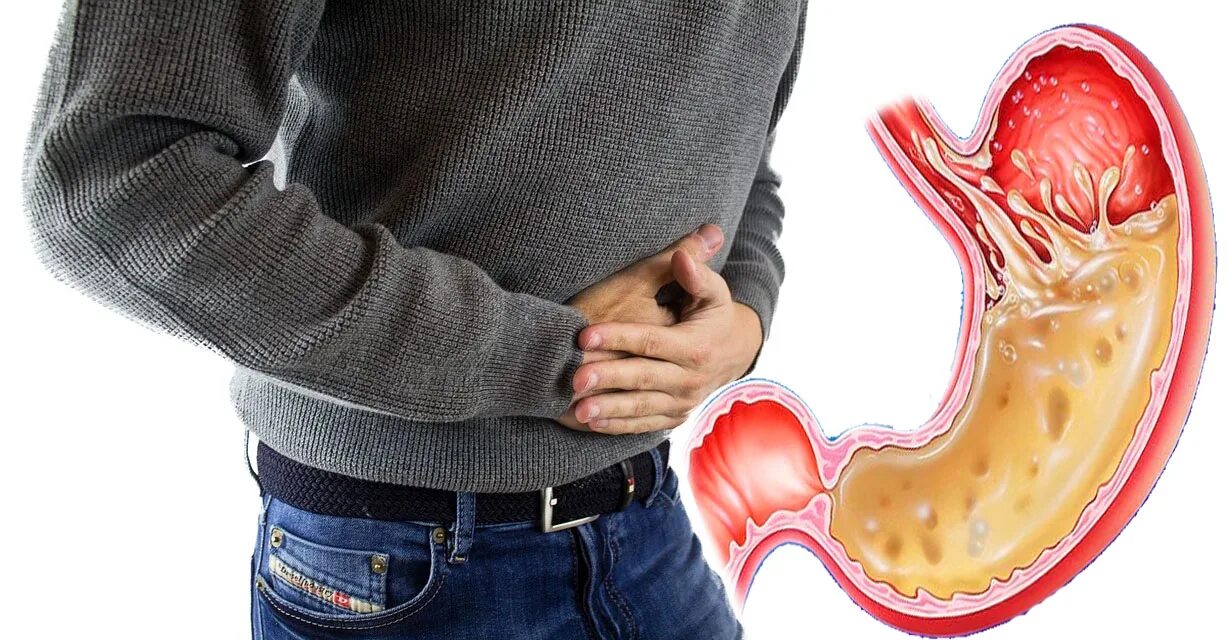 Изжога картинки. Stomach Reflux. Болит желудок от воды